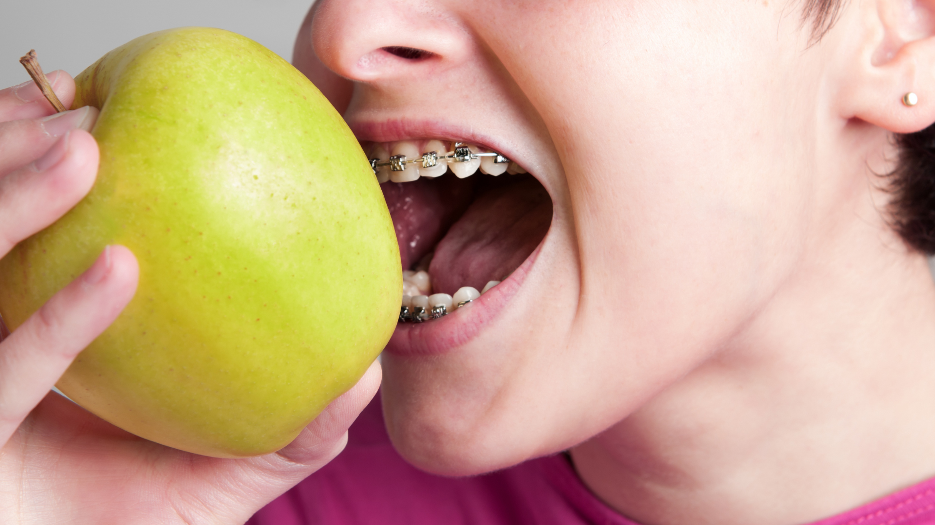 1 A young girl with braces pretending to bite a green apple.