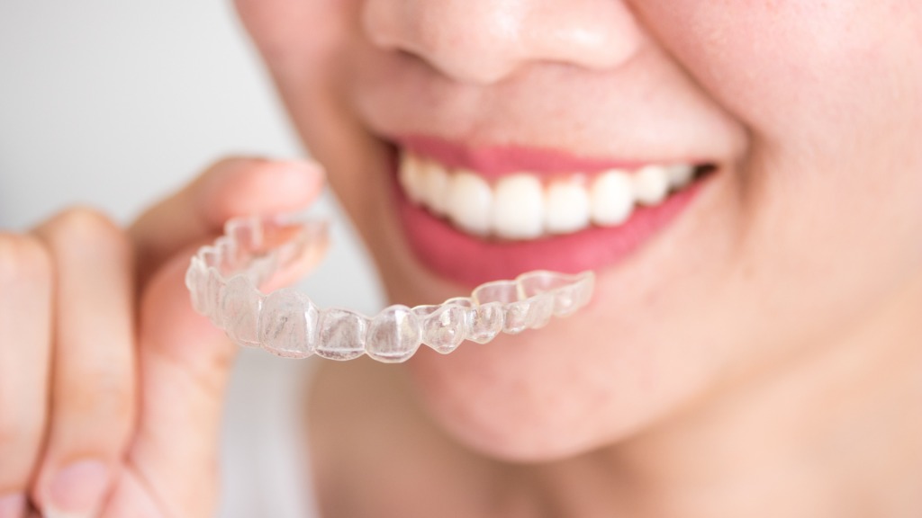 Close-up of a smiling woman’s mouth about to put her clear aligner tray in.