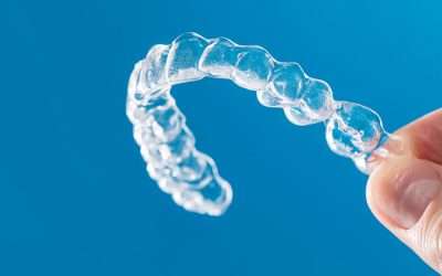 Lost or Broken Retainers? Why You Need to Act Fast