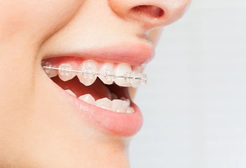 Meason Orthodontics