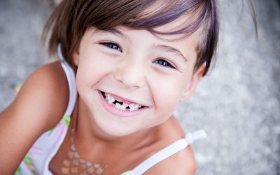 Options for Children with Missing Teeth